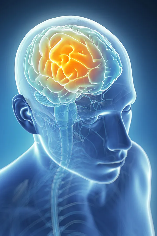 3D illustration of the brain with glowing pain center. Tanya Zboril, NP of TBT Medical treats migraines using functional medicine in Edmonton.