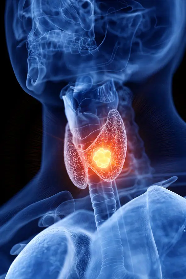 A 3D illustration of an x-ray of a human neck, highlighting the thyroid. Get help with thyroid imbalance from Tanya Zboril, NP of TBT Medical in Edmonton.
